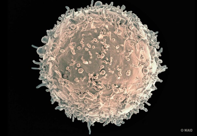 Lire la suite à propos de l’article Un nouvel anticorps prometteur découvert chez des patients « contrôleurs »